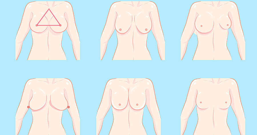 Welche Arten der Brustkorrektur gibt es?