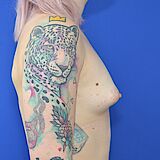 Brustvergrößerung, 39